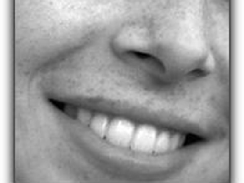 Featured image for “Time to Upgrade Your Smile?”
