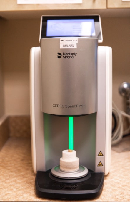 cerec technology close up 2