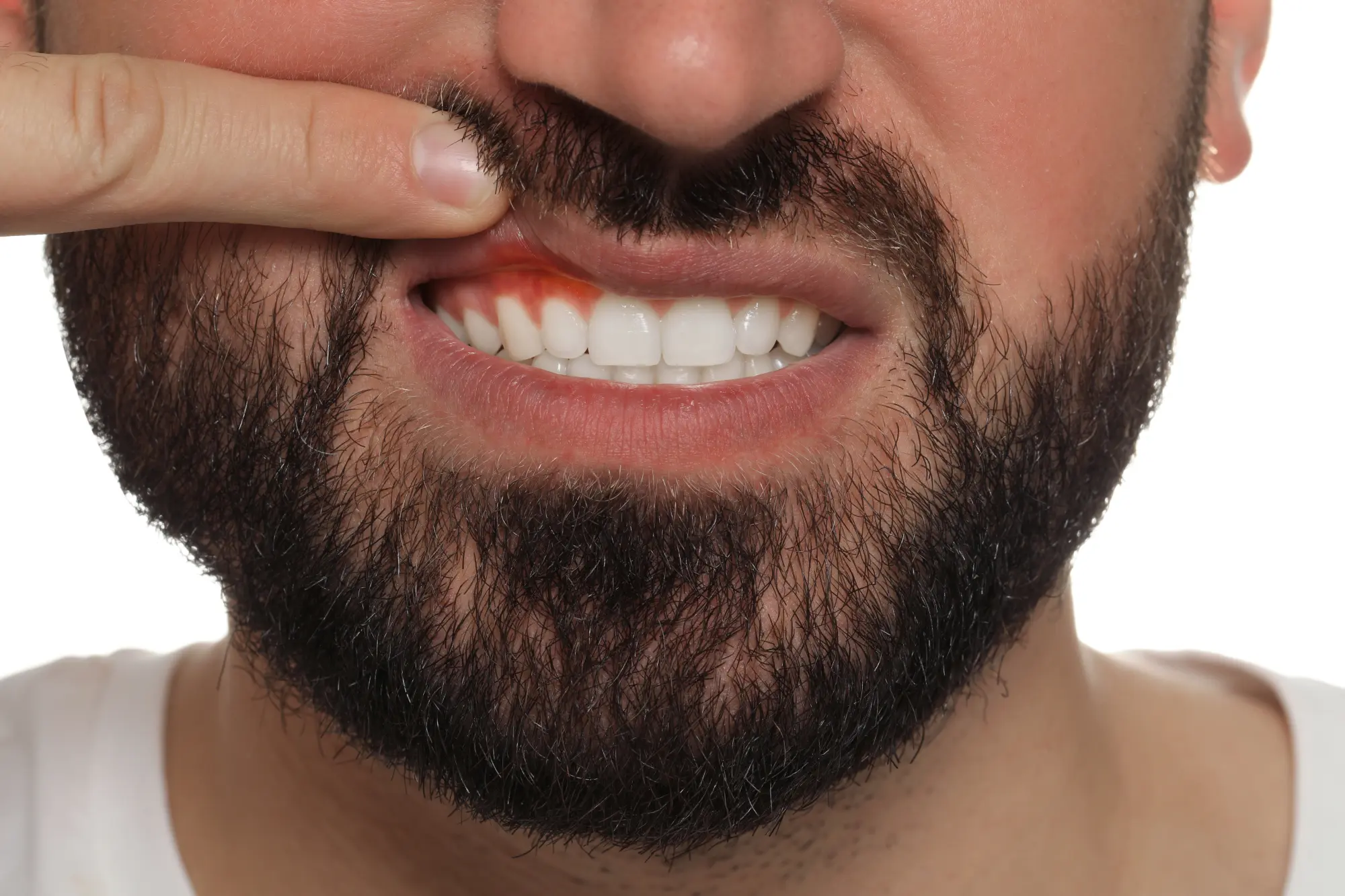 Featured image for “Oral Microbiome Testing for Gum Disease Prevention”