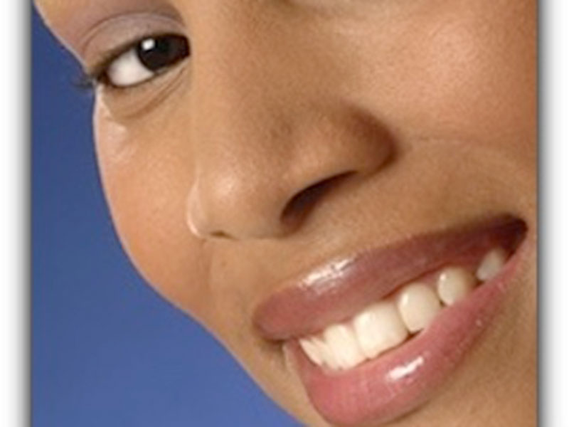 Featured image for “Are Dental Veneers Reversible?”