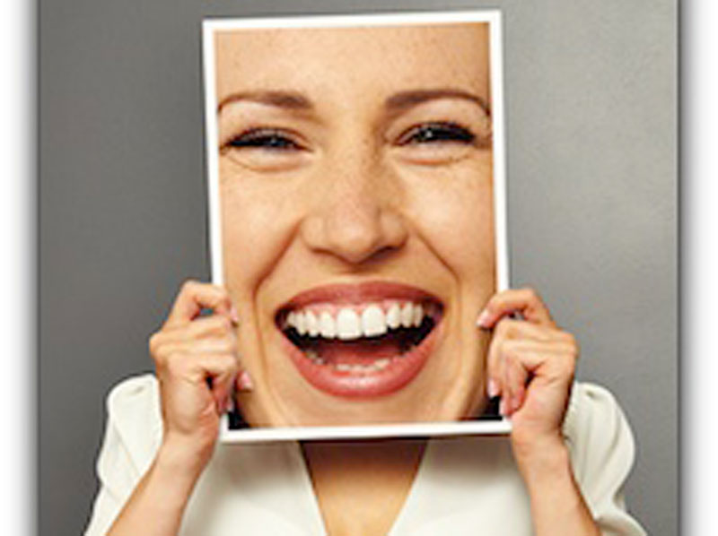 Featured image for “Do Veneers Make Teeth Look Bigger?”