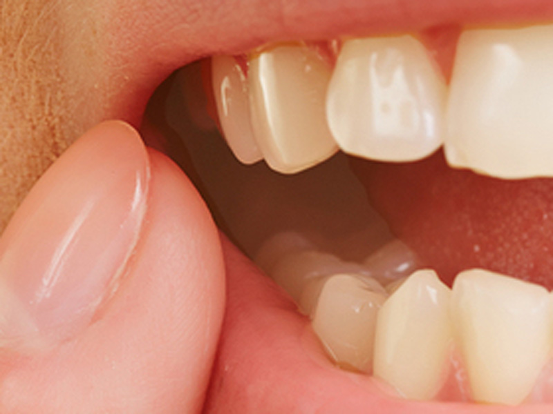 Featured image for “How Oral Inflammation Affects Your Health”