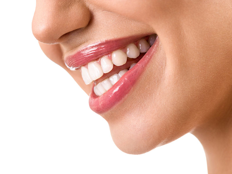 smiling women teeth