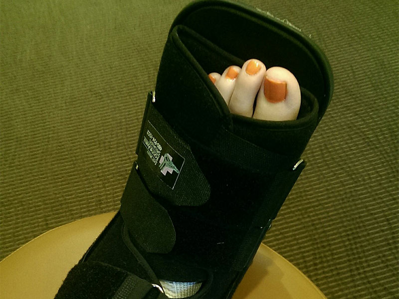 woman's foot inside a soft cast