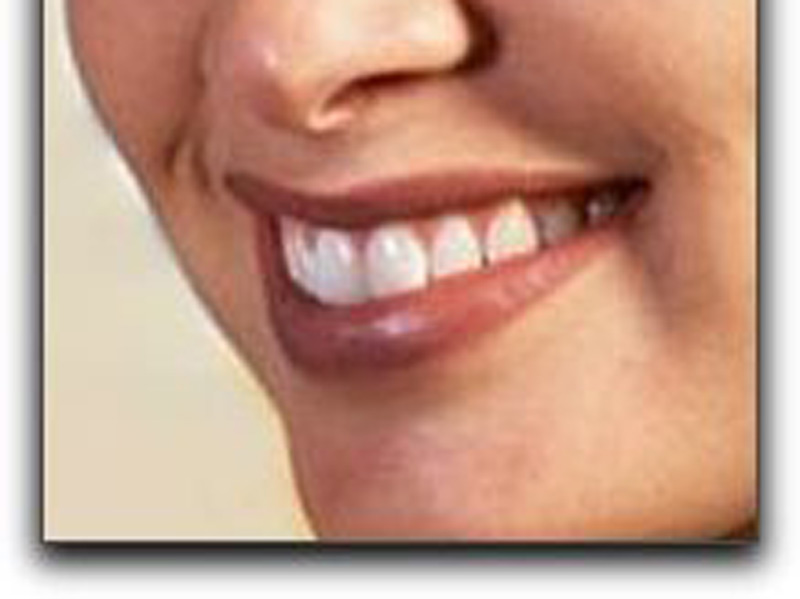 Featured image for “Don’t Settle for an Unattractive Smile”