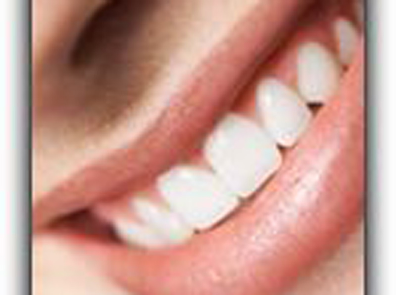 Featured image for “Want Whiter Teeth?”