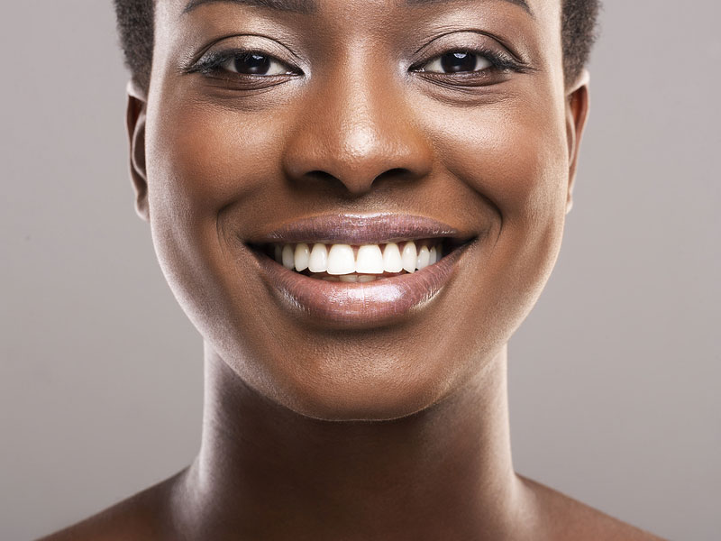 a smiling women showing teeth