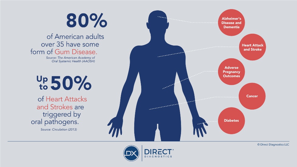 DDX Adverse Effects