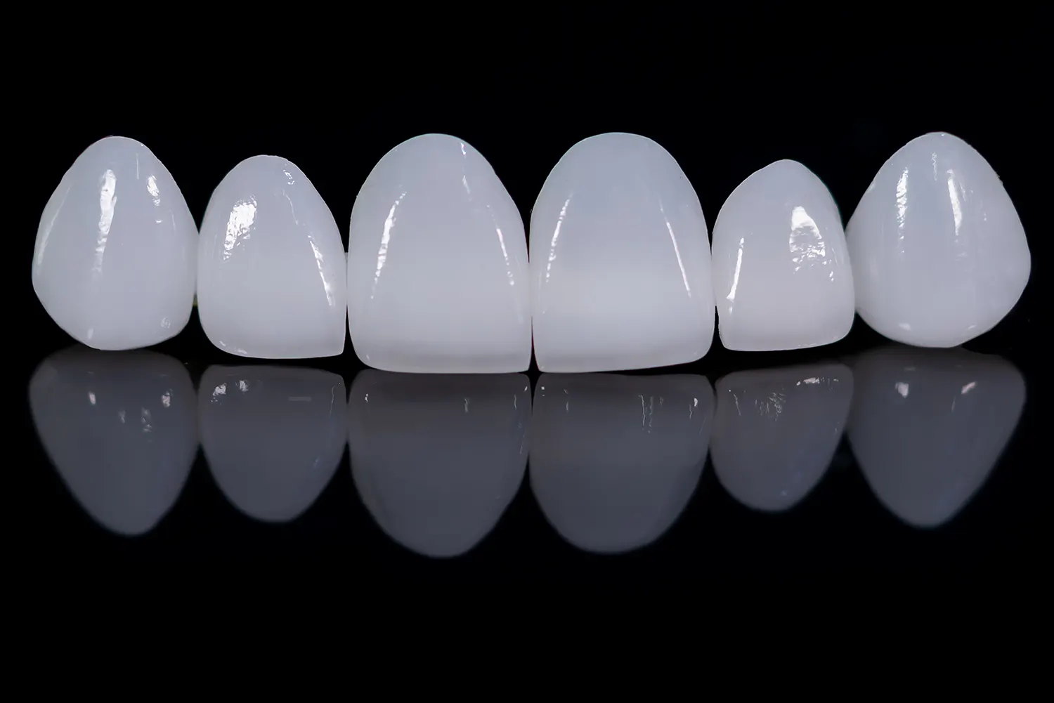Featured image for “How Long Do Veneers Last?”